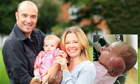 Mothers Fury After 20 Doctors Dismissed Babys Cancer Tumour As