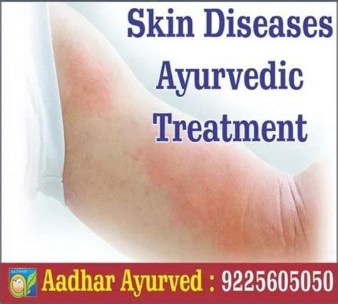 Skin Diseases Ayurvedic Treatment In India