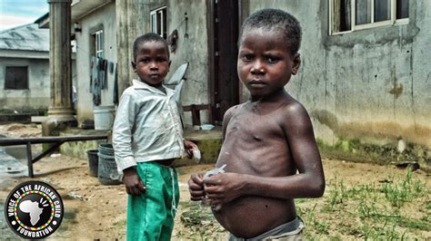 Hungry Children In Africa Weeks Left To Save East Africas Starving