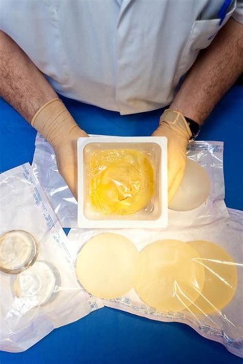 Adulterated And Explanted Poly Implant Prothese Pip French Breast Implants Superstock