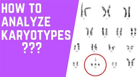How To Analyze Karyotypes 101 Youtube