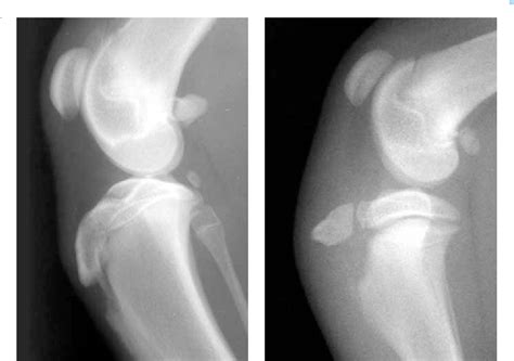Figure 6 From Does Osgood Schlatter Disease Exist In The Dog