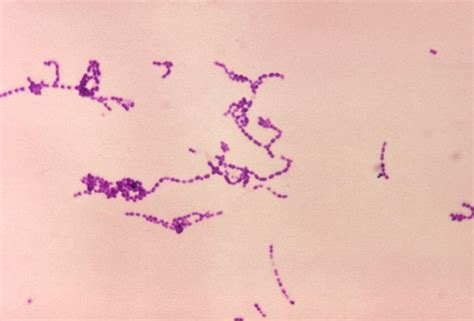 Streptococcus Spp Micro Pinterest