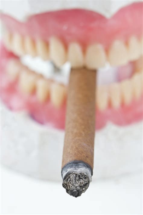 Whether You Smoke It Or Chew It Tobacco Destroys Teeth University Of