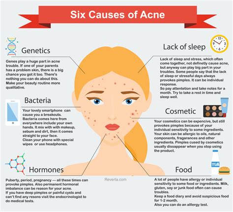 15 Causes Of Acne Why You Break Out