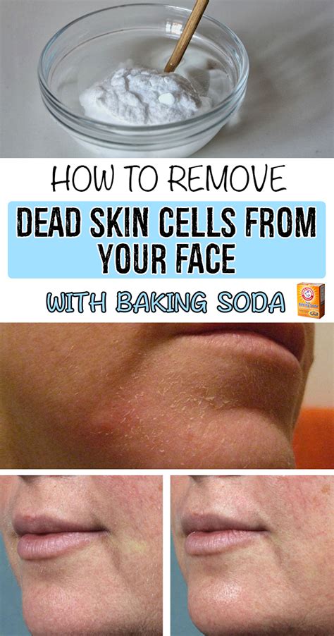 How To Remove Dead Skin Cells From Your Face With Baking