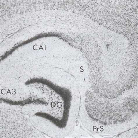 2 Coronal Section Of The Hippocampal Formation Dentate