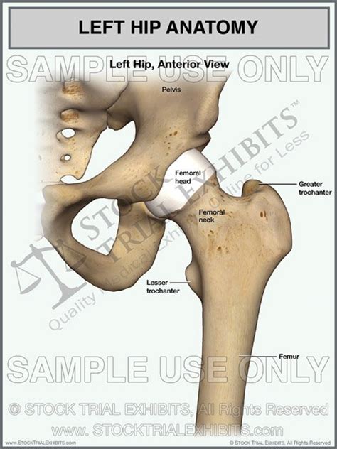 The hip's essential muscles are the sartorius, rectus femoris, gluteus minimus and medius, iliopsoas, adductors, and hamstrings. Stock Trial Exhibits - Medical Legal Visuals