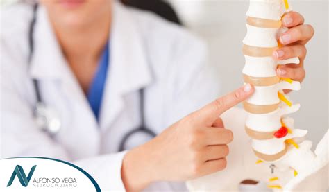 Estenosis espinal síntomas causas y tratamiento Dr Alfonso Vega