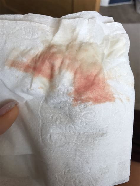 I'm 6 weeks pregnant and for the past two days i have been light spotting which looks like fresh blood and brown mucus discharge… Light Pink Spotting When I Wipe 6 Weeks Pregnant ...