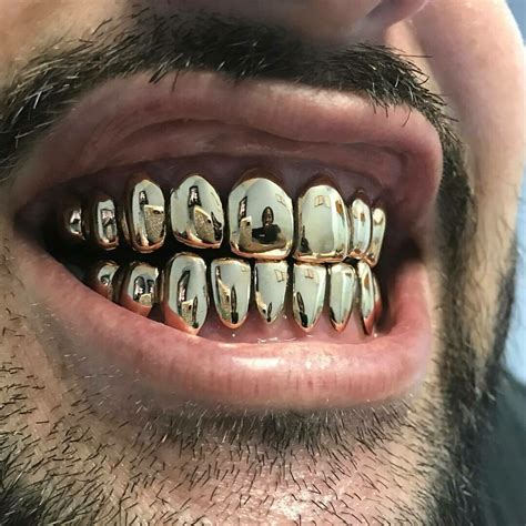 Check spelling or type a new query. 14 Karat Gold Grillz ($110 Per Tooth)