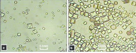 Oxalobacter formigenes and its role in oxalate langley s. Light microscope images of calcium oxalate crystals ...