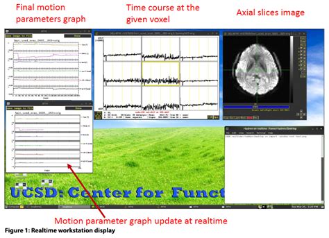 3t How To Realtime Protocol Center For Functional Mri Uc San Diego