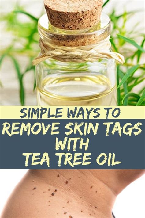simple ways to remove skin tags with tea tree oil in 2020 skin tag removal skin natural