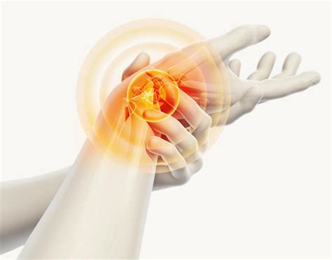 6 Common Causes Of Wrist Pain Florida Pain Medicine