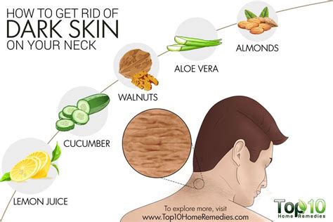How To Get Rid Of Dark Skin On Your Neck Top 10 Home Remedies