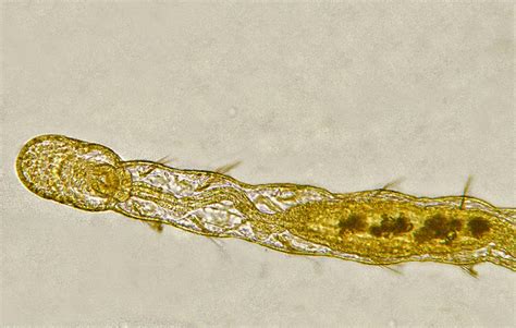 Microscopic Bristle Worm Project Noah