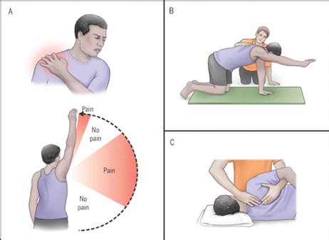 Questa manifestazione può originare dai muscoli, dall'articolazione o da. SPALLA DOLOROSA: L'ESERCIZIO FISICO PUO' RIDURRE IL DOLORE ...