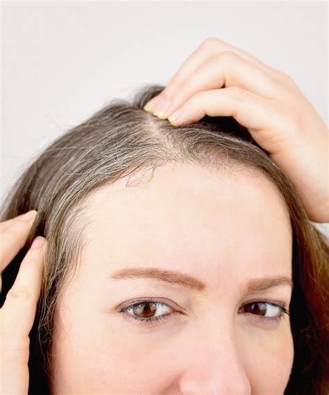 What Causes Premature Gray Hair At Young Age Reasons