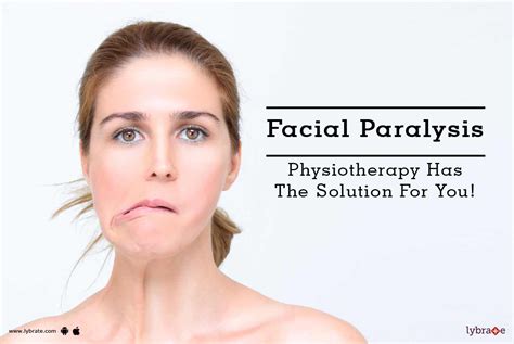 Physical Therapy For Bells Palsy Idiopathic Facial Paralysis