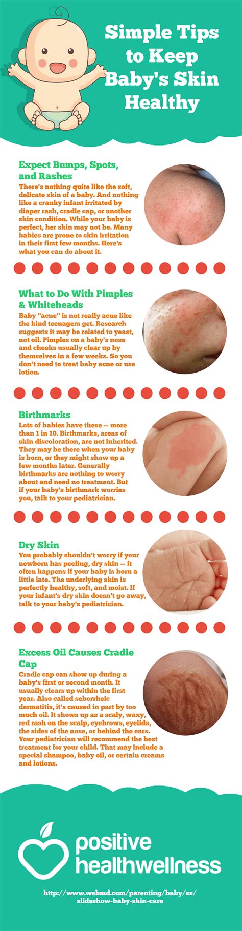 Simple Tips To Keep Babys Skin Healthy Infographic Positive Health