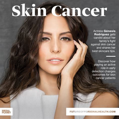 The Leaders In Skin Cancer Unite Within Mediaplanets Skin Cancer My Xxx Hot Girl