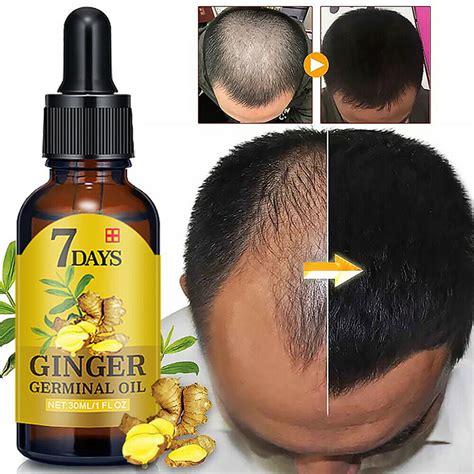 Upgraded 7 Days Ginger Germinal Oil Hair Regrowth Serum Hairdressing
