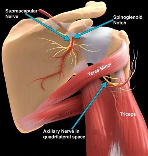 How To Relieve A Trapped Nerve In Your Shoulder Patients Lounge