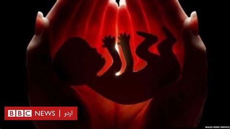 مردہ عورت کی بچہ دانی سے پہلی بار بچے کی پیدائش Bbc News اردو