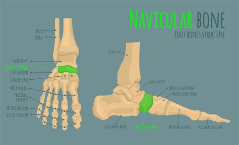 Accessory Navicular Removal The Recovery Process Little Growing Bones