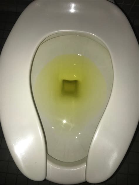 Help TMI This Looks Weird Urine Discharge Glow Community