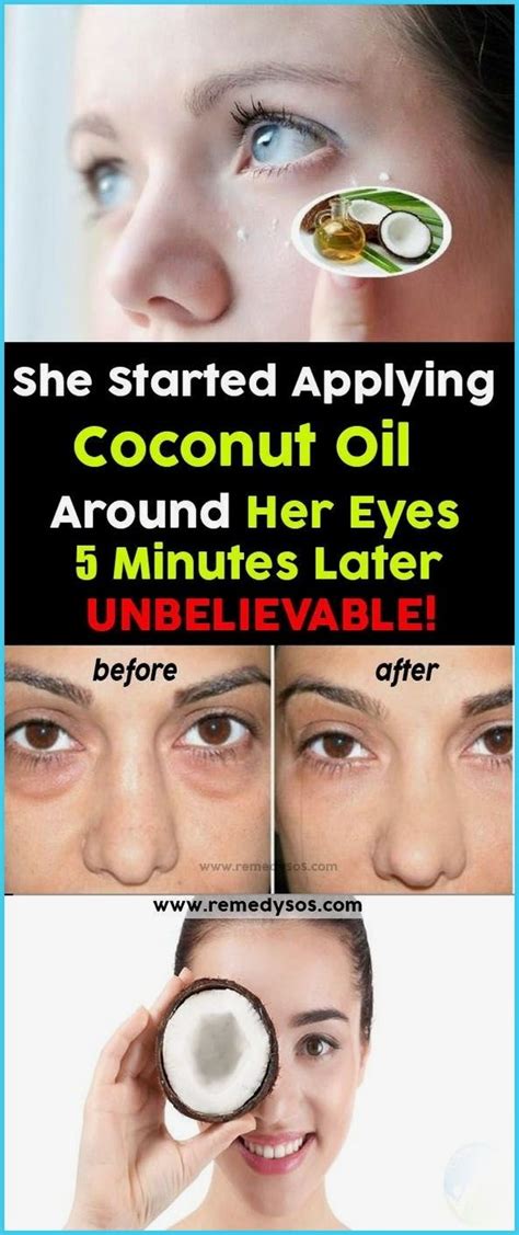 She Started Applying Coconut Oil Around Her Eyes Minutes Later