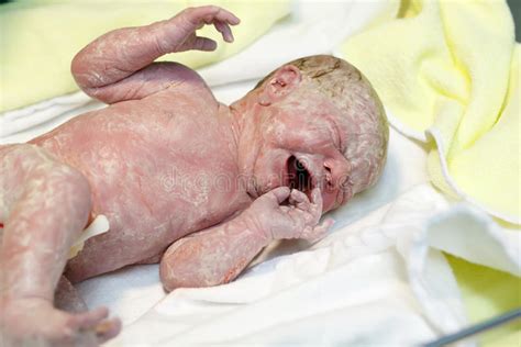 Soon after birth, a baby has to adjust to life outside the womb. Newborn Baby Child Seconds And Minutes After Birth Lying ...