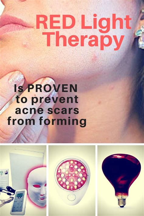 43 Best Red Light Therapy Before And After Images On Pinterest Red