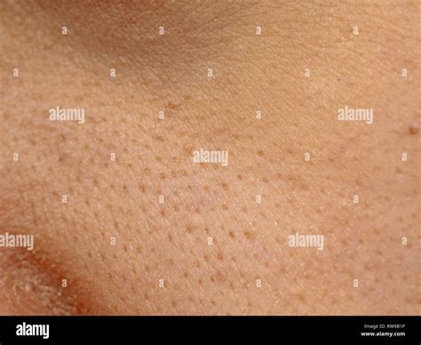Close Up Wide Pores Skin On Dry Face Of Asian Woman Female Nose And