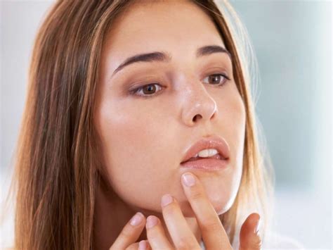 Get Rid Of Lip Pimples Swollen Big Painful Upper Inside Around Your