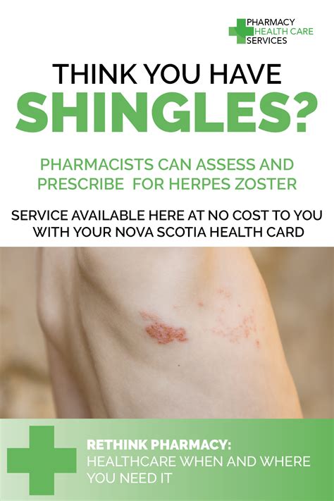 Herpes Zoster Shingles Assessing And Prescribing Pharmacy