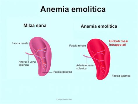 È difficile da misurare esattamente la portata di pericardite effusiva cronica sparsa poiché i sintomi non sono chiari nella maggior parte dei casi; Sintomi della sclerodermia morfea, sistemica e localizzata, diagnosi e terapia