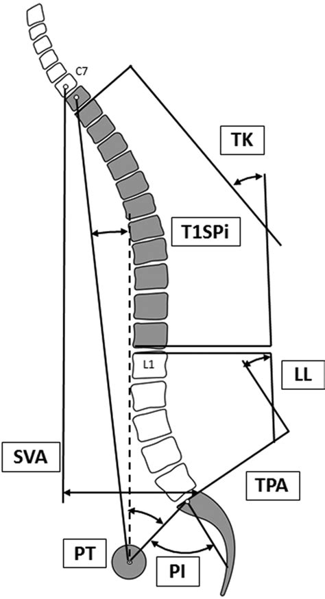Sagittal Radiographic Parameters Including Sva Ll Pi Pt T1spi And