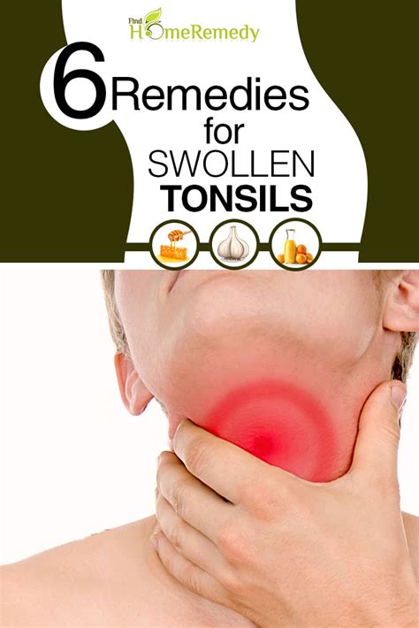 Best And Effective Ways To Get Rid Of Tonsil Stones Find Home Remedy