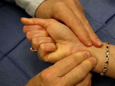 .function test t the allentest for bloodflow thumb cmc grind test tinel's test trousseau's (rula) s scaphoid shift test scapholunate dissociation supination lift test t the allentest for. Allen Test | Hand Surgery Source