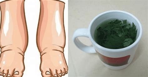 This Tea Is The Best Remedy For Swollen Legs