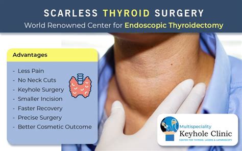 Thyroid Surgery Keyhole Clinic Thiruvananthapuram