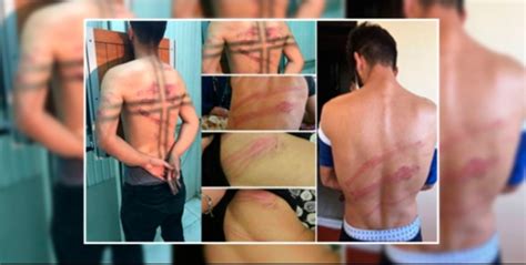 ANF HRW Denounces Torture In Custody And Abductions In Turkey