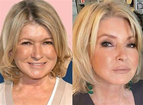 Did Martha Stewart Get A Facelift Surgery Before And After