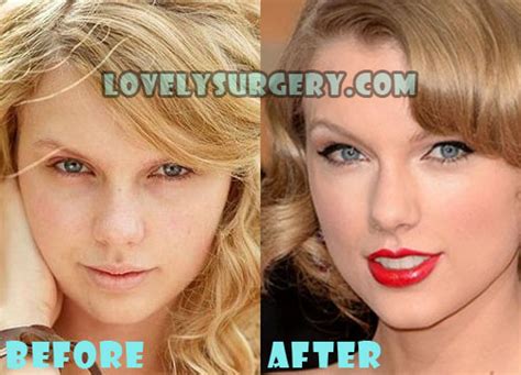 Taylor Swift Plastic Surgery Nose Job Boob Job Before After Lovely Surgery