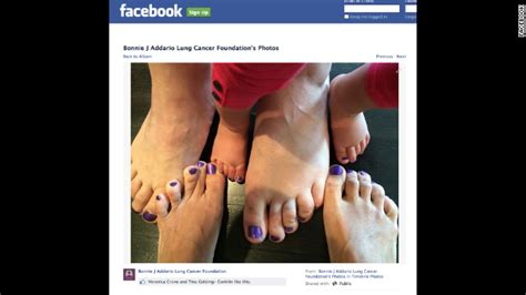 Purple Toes Campaign Fights Back Against Lung Cancer