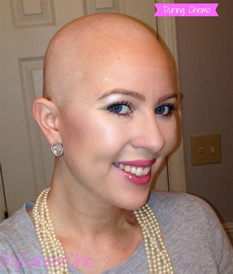 Is It Possible To Not Lose Your Hair During Chemo The Definitive