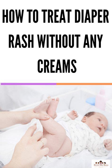 Simple Trick To Quickly Get Rid Of Diaper Rash How To Prevent Diaper
