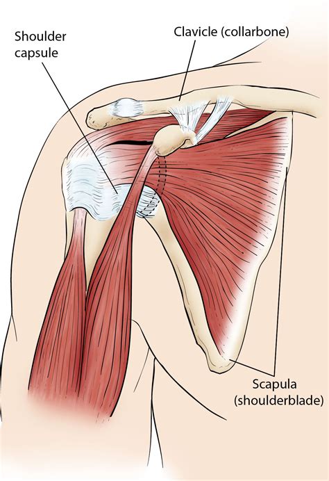 A common cause of shoulder pain is soreness of the tendon (a cord that attaches a muscle to a bone) in the rotator cuff. Frozen Shoulder (Adhesive Capsulitis) - is it causing your ...